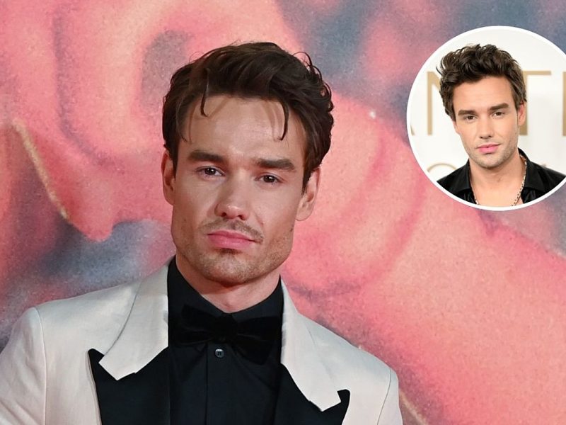 Fans Question, ‘Did Liam Payne Get Plastic Surgery?’