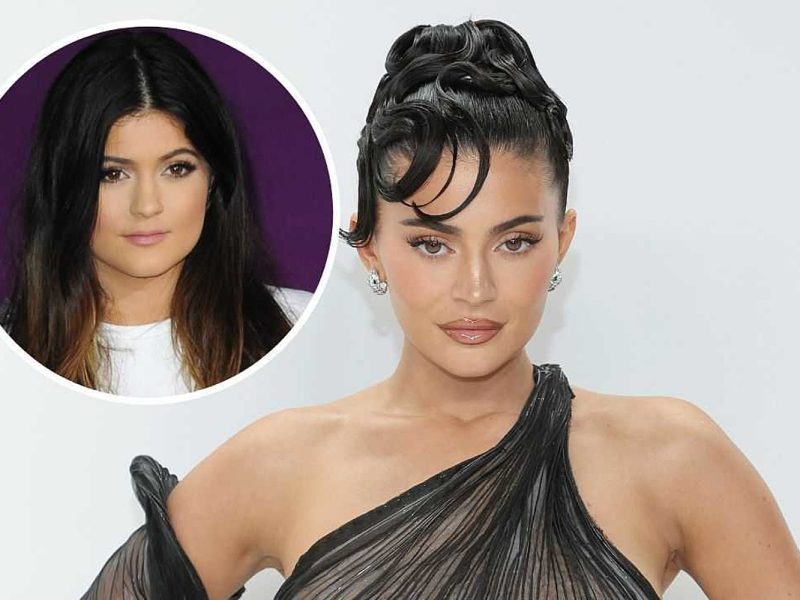 What Plastic Surgery Has Kylie Jenner Had Done?