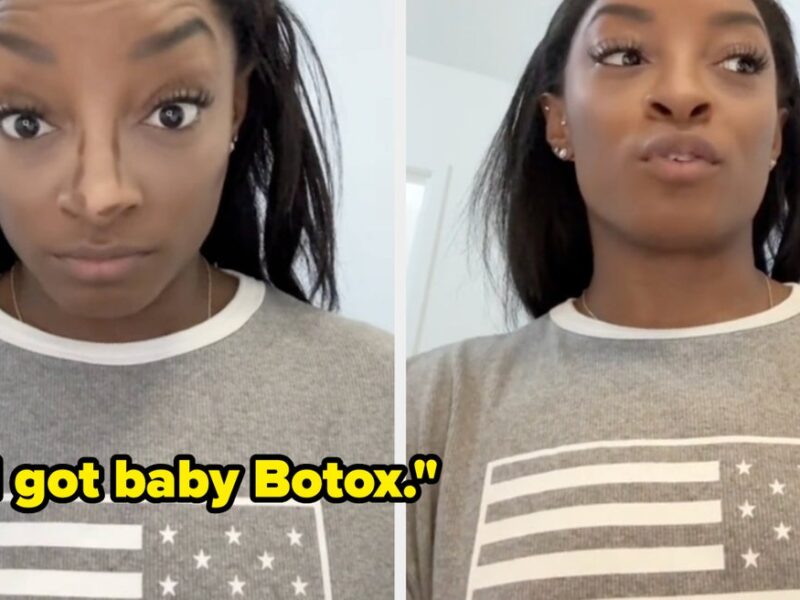 Simone Biles Discussed Her Experience With Botox