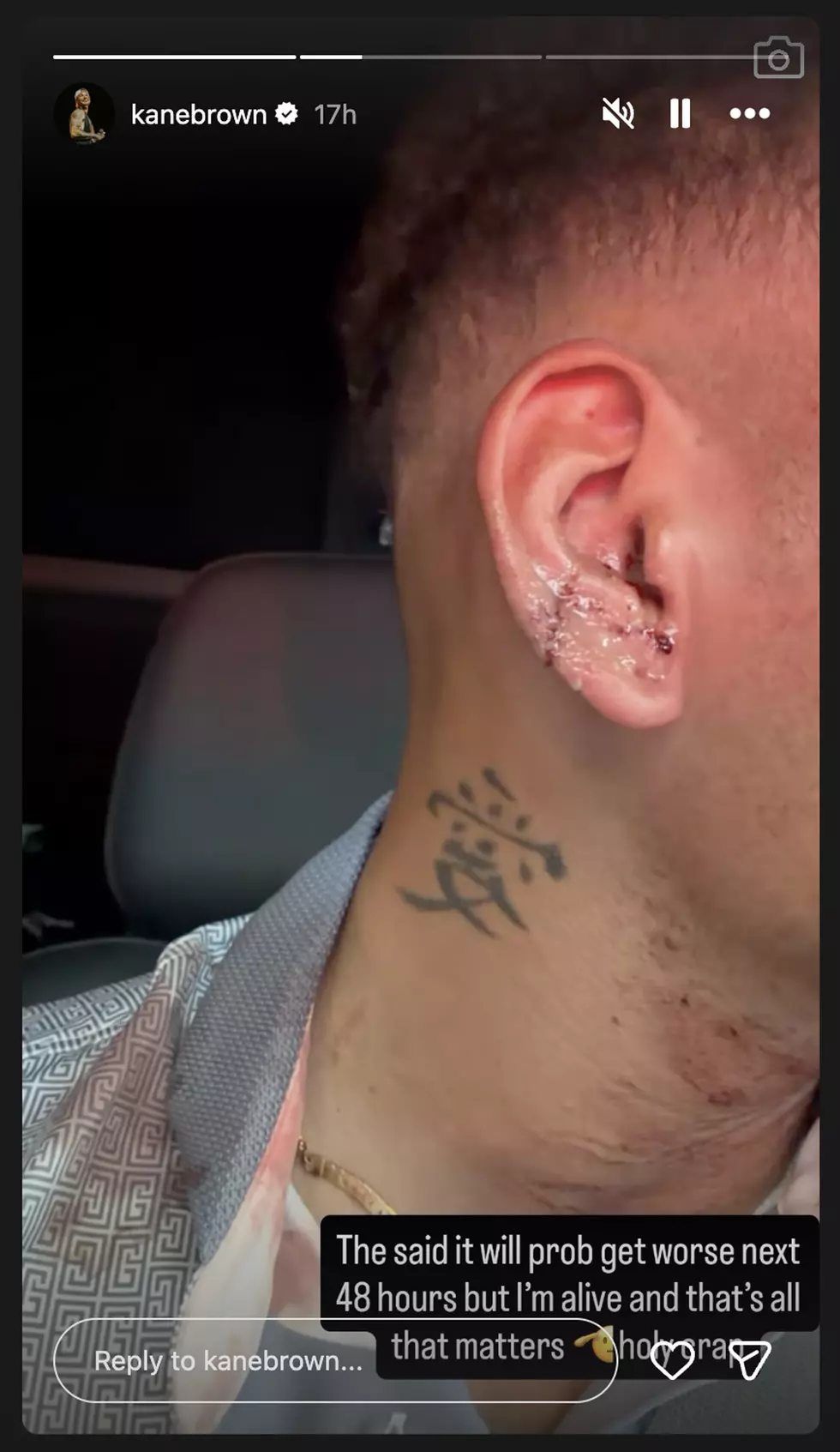 Kane Brown recovery photos